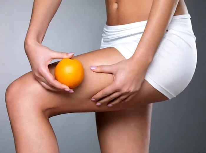 Consigli per sbarazzarsi della cellulite / foto: Freepik