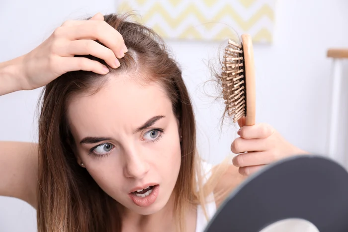 I problemi dei capelli sono difficili da nascondere, ma possono essere facilmente risolti. / foto: Shutterstock