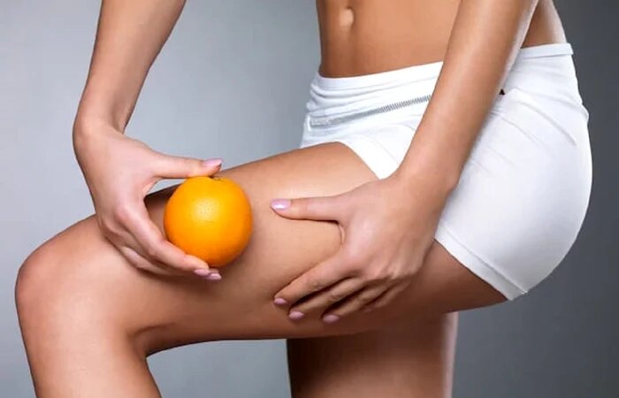 5 passi semplici ed efficaci per eliminare la cellulite. Dimentica i trattamenti costosi!