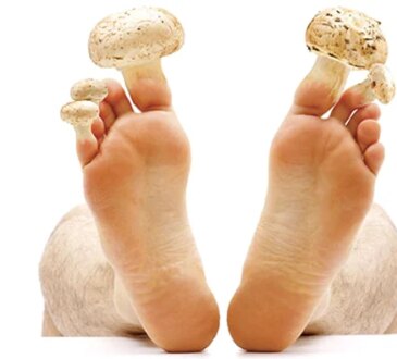 Con solo 2 ingredienti, prepara questo scrub naturale ed elimina i funghi dei piedi. Avrai gambe belle e sane