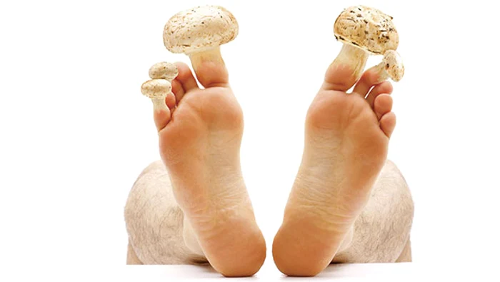 Con solo 2 ingredienti, prepara questo scrub naturale ed elimina i funghi dei piedi. Avrai gambe belle e sane