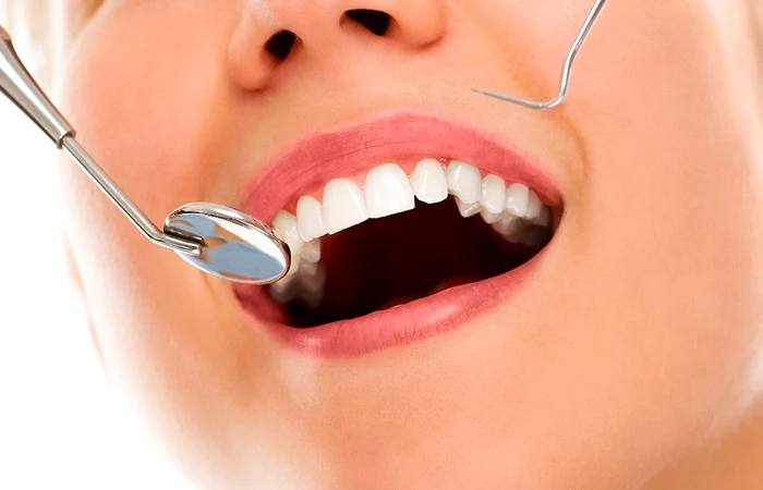 Il bicarbonato di sodio fa bene ai denti? 4 modi efficaci per usarlo per avere denti bianchi